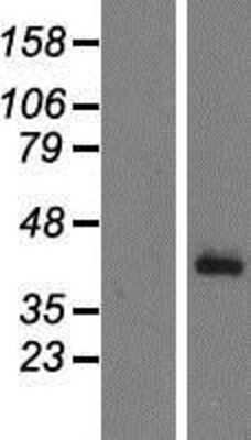 Western Blot Complement Factor H-related 1/CFHR1/CFHL1 Overexpression Lysate