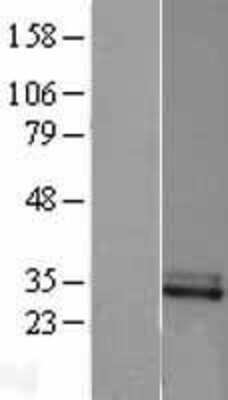 Western Blot: CFHL2 Overexpression Lysate (Adult Normal) [NBL1-09123] Left-Empty vector transfected control cell lysate (HEK293 cell lysate); Right -Over-expression Lysate for CFHL2.