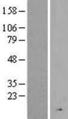 Western Blot: CFHR4 Overexpression Lysate (Adult Normal) [NBP2-07592] Left-Empty vector transfected control cell lysate (HEK293 cell lysate); Right -Over-expression Lysate for CFHR4.