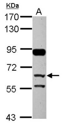 Western Blot: CFHR5 Antibody [NBP2-14912] - Sample (30 ug of whole cell lysate) A: HepG2 7. 5% SDS PAGE, antibody diluted at 1:3000.