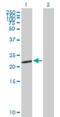 Western Blot: CGB5 Antibody [H00093659-B01P] - Analysis of CGB5 expression in transfected 293T cell line by CGB5 polyclonal antibody.  Lane1:CGB5 transfected lysate(18.15 KDa). Lane2:Non-transfected lysate.