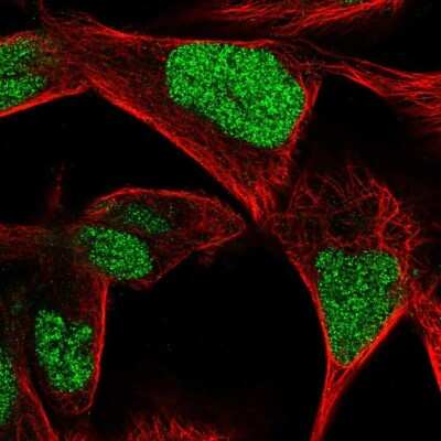 <b>Independent Antibodies Validation. </b>Immunocytochemistry/Immunofluorescence: CGGBP1 Antibody [NBP2-32680] - Immunofluorescent staining of human cell line RH-30 shows localization to nucleus.
