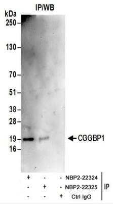 <b>Biological Strategies Validation. </b>Immunoprecipitation: CGGBP1 Antibody [NBP2-22325] - Whole cell lysate (1 mg for IP; 20% of IP loaded) from 293T cells.  Antibodies:  NBP2-22325 used for IP at 6 ug/mg lysate.  CGGBP1 was also immunoprecipitated by rabbit anti-CGGBP1 antibody NBP2-22324.  For blotting immunoprecipitated CGGBP1, NBP2-22325 was used at 1 ug/ml.  Detection: Chemiluminescence with an exposure time of 3 minutes.