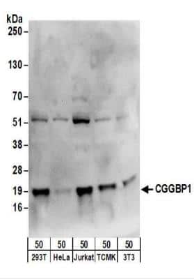Western Blot: CGGBP1 Antibody [NBP2-22325] - Whole cell lysate (50 ug) from 293T, HeLa, Jurkat, mouse TCMK-1, and mouse NIH3T3 cells.  NBP2-22325 used for WB at 1 ug/ml.  Detection: Chemiluminescence with an exposure time of 10 seconds.