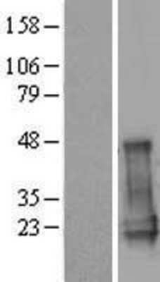 Western Blot: CGGBP1 Overexpression Lysate (Adult Normal) [NBP2-08807] Left-Empty vector transfected control cell lysate (HEK293 cell lysate); Right -Over-expression Lysate for CGGBP1.