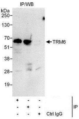 Immunoprecipitation: CGI-09 Antibody [NBP1-50039] - Detection of Human TRM6 by Western Blot of Immunoprecipitates.  Samples:  Whole cell lysate (1 mg for IP, 20% of IP loaded) from HeLa cells.  Antibodies: Affinity purified rabbit anti-TRM6 antibody used for IP at 6 mcg/mg lysate.  TRM6 was also immunoprecipitated by rabbit anti-TRM6 antibody which recognizes a downstream epitope. For blotting immunoprecipitated TRM6 was used at 1 mcg/ml, and the ReliaBLOT Reagents and Procedures were incorporated. Detection: Chemiluminescence with an exposure time of 10 seconds.