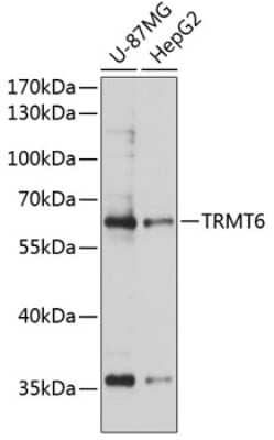 Western Blot: CGI-09 Antibody [NBP2-92578] - Analysis of extracts of various cell lines, using CGI-09 at 1:3000 dilution. Secondary antibody: HRP Goat Anti-Rabbit IgG (H+L) at 1:10000 dilution. Lysates/proteins: 25ug per lane. Blocking buffer: 3% nonfat dry milk in TBST. Detection: ECL Basic Kit . Exposure time: 10s.