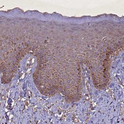 Immunohistochemistry-Paraffin: CGI-128 Antibody [NBP1-88092] - Staining of human fallopian tube shows moderate cytoplasmic positivity in glandular cells.