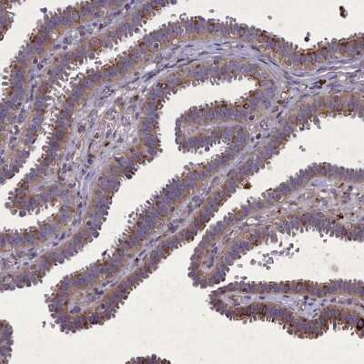 Immunohistochemistry-Paraffin: CGI-128 Antibody [NBP1-88092] - Staining of human fallopian tube shows moderate cytoplasmic positivity in glandular cells.