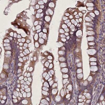 Immunohistochemistry-Paraffin: CGI-128 Antibody [NBP1-88092] - Staining of human skin shows moderate cytoplasmic positivity in epidermal cells.