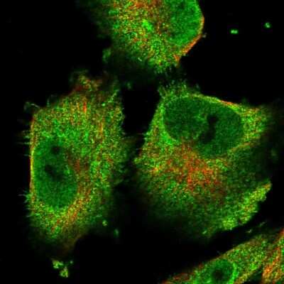 Immunocytochemistry/Immunofluorescence: CGI-16 Antibody [NBP1-90275] - Immunofluorescent staining of human cell line U-251 MG shows localization to nucleoplasm, plasma membrane & cytosol.