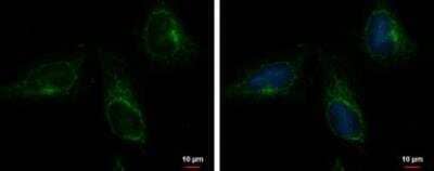 Immunocytochemistry/Immunofluorescence: CGI-16 Antibody [NBP2-15872] - ACOT9 antibody detects ACOT9 protein at mitochondria by immunofluorescent analysis. Sample: HeLa cells were fixed in ice-cold MeOH for 5 min.