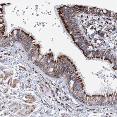 Immunohistochemistry-Paraffin: CGI-16 Antibody [NBP1-90275] - Staining of human bronchus shows strong granular cytoplasmic positivity in respiratory epithelial cells.