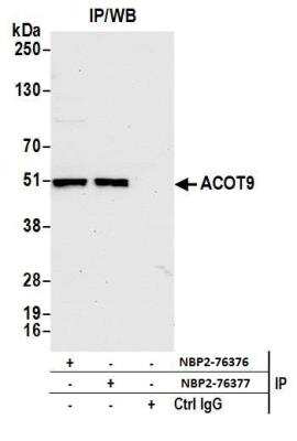 Immunoprecipitation: CGI-16 Antibody [NBP2-76377] - Samples: Whole cell lysate (1.0 mg per IP reaction; 20% of IP loaded) from HEK293T cells prepared using NETN lysis buffer. Antibodies: Affinity purified rabbit anti-ACOT9 antibody NBP2-76377 used for IP at 100 ul per reaction. ACOT9 was also immunoprecipitated by rabbit anti-ACOT9 antibody NBP2-76376. For blotting immunoprecipitated ACOT9, NBP2-76377 was used at 1:100. Detection: Chemiluminescence with an exposure time of 30 seconds.