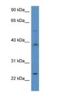 Western Blot: CGI-16 Antibody [NBP1-74084] - Titration: 1.0 ug/ml Positive Control: MDA-MB-435S Whole Cell.