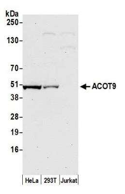 Western Blot: CGI-16 Antibody [NBP2-76376] - Samples: Whole cell lysate (50 ug) from HeLa, HEK293T, and Jurkat cells prepared using NETN lysis buffer. Antibody: Affinity purified rabbit anti-ACOT9 antibody NBP2-76376 used for WB at 1:1000. Detection: Chemiluminescence with an exposure time of 30 seconds.