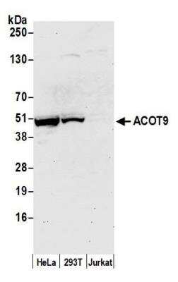 Western Blot: CGI-16 Antibody [NBP2-76377] - Samples: Whole cell lysate (50 ug) from HeLa, HEK293T, and Jurkat cells prepared using NETN lysis buffer. Antibody: Affinity purified rabbit anti-ACOT9 antibody NBP2-76377 used for WB at 1:1000. Detection: Chemiluminescence with an exposure time of 30 seconds.