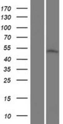 Western Blot CGI-16 Overexpression Lysate