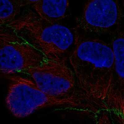 Immunocytochemistry/Immunofluorescence: CGNL1 Antibody [NBP2-56274] - Staining of human cell line CACO-2 shows localization to cell junctions.