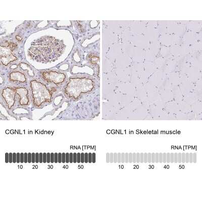 Immunohistochemistry-Paraffin CGNL1 Antibody