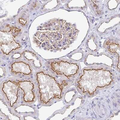 Immunohistochemistry-Paraffin CGNL1 Antibody