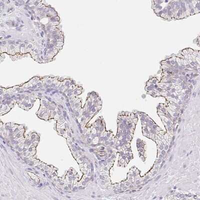 Immunohistochemistry-Paraffin: CGNL1 Antibody [NBP2-37959] - Staining of human prostate shows moderate membranous positivity in glandular cells.