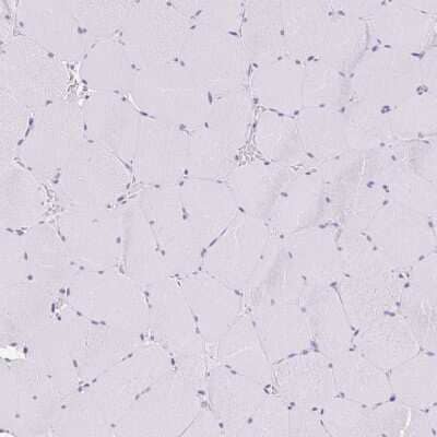 Immunohistochemistry-Paraffin: CGNL1 Antibody [NBP2-37959] - Staining of human skeletal muscle shows no positivity in myocytes as expected.