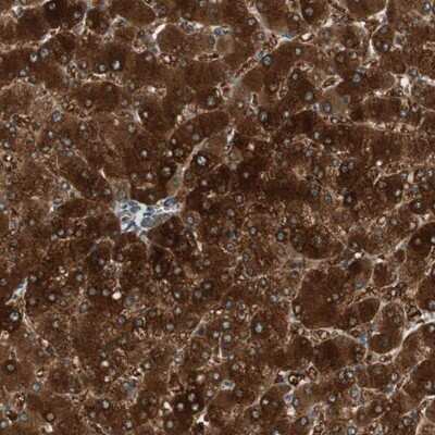 Immunohistochemistry-Paraffin CGR19 Antibody