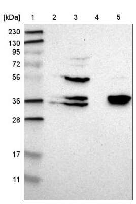 Western Blot CGR19 Antibody