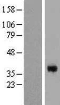 Western Blot: CGR19 Overexpression Lysate (Adult Normal) [NBL1-09137] Left-Empty vector transfected control cell lysate (HEK293 cell lysate); Right -Over-expression Lysate for CGR19.