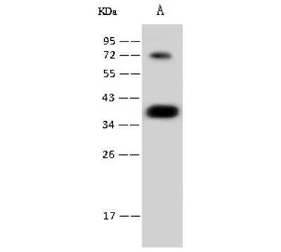 Western Blot: CGREF1 Antibody (001) [NBP2-90214] - Anti-CGREF1 rabbit monoclonal antibody at 1:500 dilution. Lane A: HL-60 Whole Cell Lysate Lysates/proteins at 30 ug per lane. Secondary: Goat Anti-Rabbit IgG (H+L)/HRP at 1/10000 dilution. Developed using the ECL technique. Performed under reducing conditions. Predicted band size:32 kDa Observed band size:37 kDa