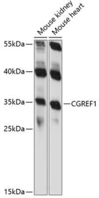 Western Blot: CGREF1 Antibody [NBP2-92188] - Analysis of extracts of various cell lines, using CGREF1 at 1:1000 dilution.Secondary antibody: HRP Goat Anti-Rabbit IgG (H+L) at 1:10000 dilution.Lysates/proteins: 25ug per lane.Blocking buffer: 3% nonfat dry milk in TBST.Detection: ECL Basic Kit .Exposure time: 90s.