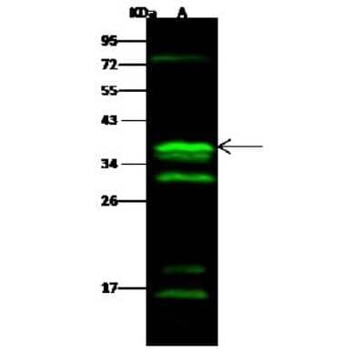 Western Blot: CGREF1 Antibody [NBP2-99923] - Anti-CGREF1 rabbit polyclonal antibody at 1:500 dilution. Lane A: HL60 Whole Cell Lysate. Lysates/proteins at 30 ug per lane. Secondary Goat Anti- Rabbit IgG H&L (Dylight 800) at 1/10000 dilution. Developed using the Odyssey technique. Performed under reducing conditions. Predicted band size: 32 kDa. Observed band size: 37 kDa (We are unsure as to the identity of these extra bands).