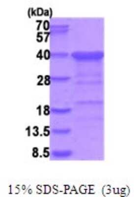 SDS-Page: CGREF1 Recombinant Protein [NBP2-51928] - 15% SDS Page (3 ug)