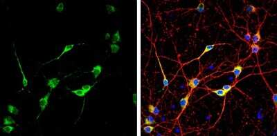 Immunocytochemistry/Immunofluorescence: CGRP Antibody [NBP3-13330] - Calcitonin antibody detects Calcitonin protein by immunofluorescent analysis. Sample: DIV10 rat E18 primary cortical neuron cells were fixed in 4% paraformaldehyde at RT for 15 min. Green: Calcitonin stained by Calcitonin antibody (NBP3-13330) diluted at 1:500. Red: alpha Tubulin, stained by alpha Tubulin antibody [GT114] (NBP2-43837) diluted at 1:500. Blue: Fluoroshield with DAPI.