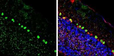 Immunohistochemistry-Frozen: CGRP Antibody [NBP3-13330] - Calcitonin antibody detects Calcitonin protein by immunohistochemical analysis. Sample: Frozen-sectioned mouse cerebellum. Green: Calcitonin stained by Calcitonin antibody (NBP3-13330) diluted at 1:250. Red: NF-H, stained by NF-H antibody [GT114] diluted at 1:500. Blue: Fluoroshield with DAPI.