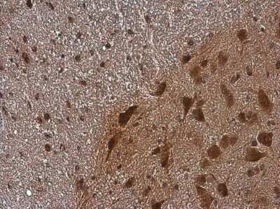 Immunohistochemistry-Paraffin: CGRP Antibody [NBP3-13330] - Mouse spinal cord . Calcitonin stained by Calcitonin antibody (NBP3-13330) diluted at 1:500. Antigen Retrieval: Citrate buffer, pH 6.0, 15 min.