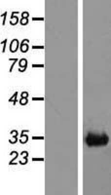 Western Blot: CH25H Overexpression Lysate (Adult Normal) [NBL1-09138] Left-Empty vector transfected control cell lysate (HEK293 cell lysate); Right -Over-expression Lysate for CH25H.