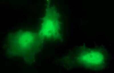 Immunocytochemistry/Immunofluorescence: CHAC1 Antibody (OTI1E2) [NBP2-46273] - Analysis  of COS7 cells transiently transfected by pCMV6-ENTRY CHAC1.