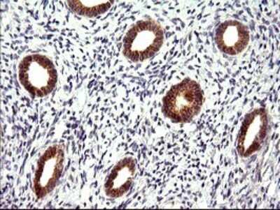 Immunohistochemistry: CHAC1 Antibody (OTI1E2) [NBP2-46273] - Analysis of Human endometrium tissue. (Heat-induced epitope retrieval by 10mM citric buffer, pH6.0, 120C for 3min)