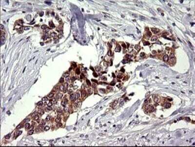 Immunohistochemistry: CHAC1 Antibody (OTI1E2) [NBP2-46273] - Analysis of Human bladder tissue. (Heat-induced epitope retrieval by 10mM citric buffer, pH6.0, 120C for 3min)