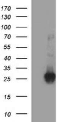 Western Blot: CHAC1 Antibody (OTI1E2) [NBP2-46273] - Analysis of HEK293T cells were transfected with the pCMV6-ENTRY control (Left lane) or pCMV6-ENTRY CHAC1.