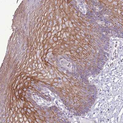 Immunohistochemistry-Paraffin: CHAC2 Antibody [NBP2-14476] - Staining of human esophagus shows distinct cytoplasmic and membranous positivity in superficial squamous epithelial cells.
