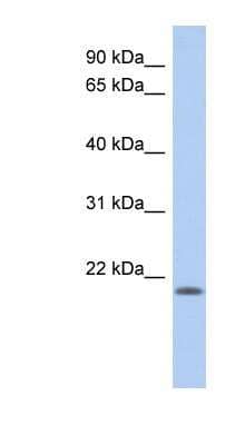 Western Blot: CHAC2 Antibody [NBP1-56821] - Human Placenta lysate, concentration 0.2-1 ug/ml.