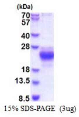 SDS-Page: CHAC2 Recombinant Protein [NBP2-51528] - 15% SDS Page (3 ug)