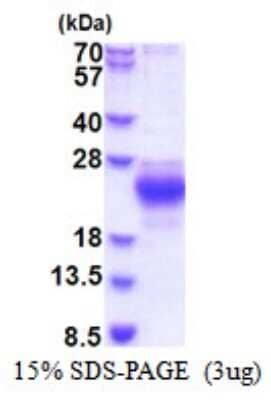 SDS-Page: CHAC2 Recombinant Protein [NBP2-51528] - 15% SDS Page (3 ug)