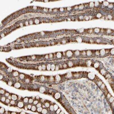 Immunohistochemistry: CHADL Antibody [NBP1-90662] - Staining of human colon shows strong cytoplasmic positivity in glandular cells.
