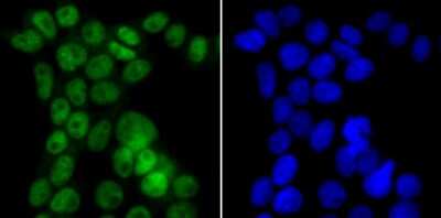 Immunocytochemistry/Immunofluorescence: CHAF1A Antibody (JG38-98) [NBP2-76859] - ICC staining p150 CAF1 in 293T cells (green). The nuclear counter stain is DAPI (blue). Cells were fixed in paraformaldehyde, permeabilised with 0.25% Triton X100/PBS.