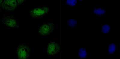 Immunocytochemistry/Immunofluorescence: CHAF1A Antibody (JG38-98) [NBP2-76859] - ICC staining p150 CAF1 in A431 cells (green). The nuclear counter stain is DAPI (blue). Cells were fixed in paraformaldehyde, permeabilised with 0.25% Triton X100/PBS.