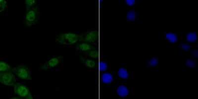 Immunocytochemistry/Immunofluorescence: CHAF1A Antibody (JG38-98) [NBP2-76859] - ICC staining p150 CAF1 in LOVO cells (green). The nuclear counter stain is DAPI (blue). Cells were fixed in paraformaldehyde, permeabilised with 0.25% Triton X100/PBS.